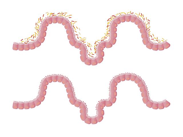 Personalizing Your Gut Health Journey: Tailored Recommendations for Diverse Needs